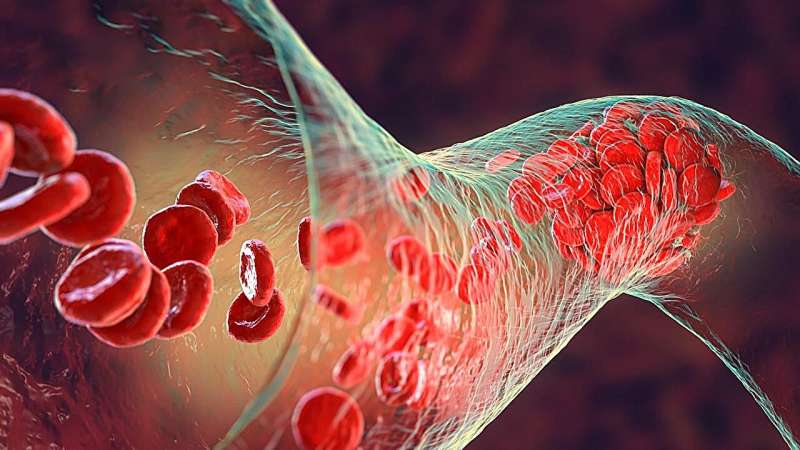 Reduced-dose anticoagulants not noninferior for recurrent venous thromboembolism