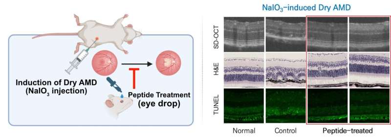 Development of a global innovative drug in eye drop form for treating dry age-related macular degeneration