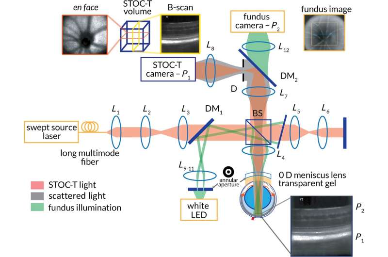 Using advanced optical tomography to assess ocular microcirculation