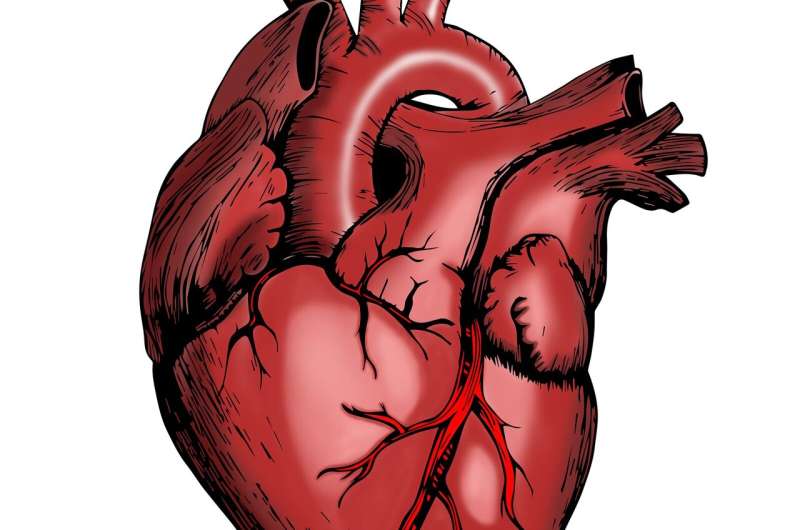 Unexpected heart muscle growth found in patients with artificial hearts