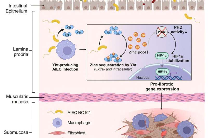 Researchers identify key driver of fibrosis in Crohn's disease