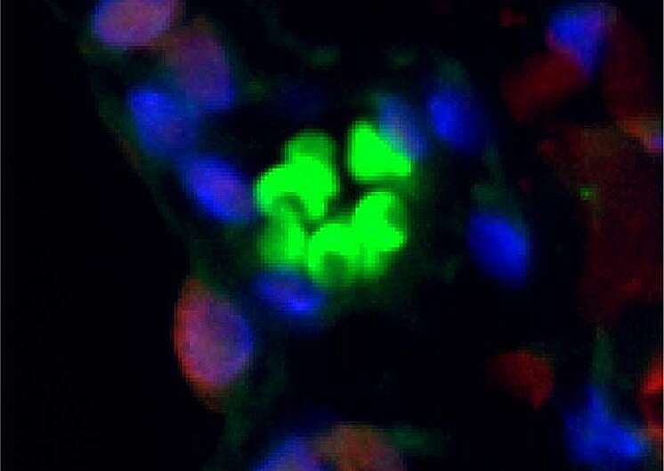 Unclogging the immune system: Scientists create immunotherapy method to remove aging cell buildup