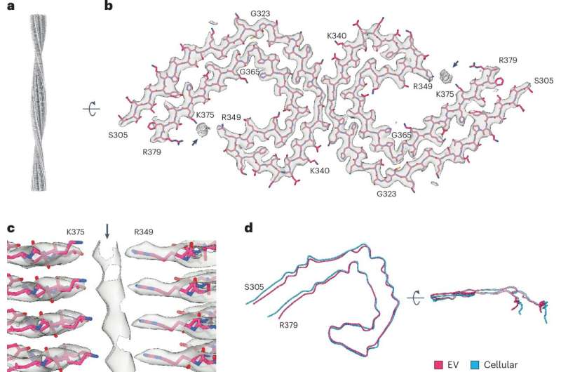 Study explores association between Tau filaments and extracellular vesicles in Alzheimer's disease