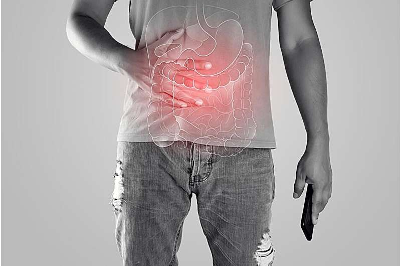 Upadacitinib found to improve ulcerative colitis outcomes at 12 months