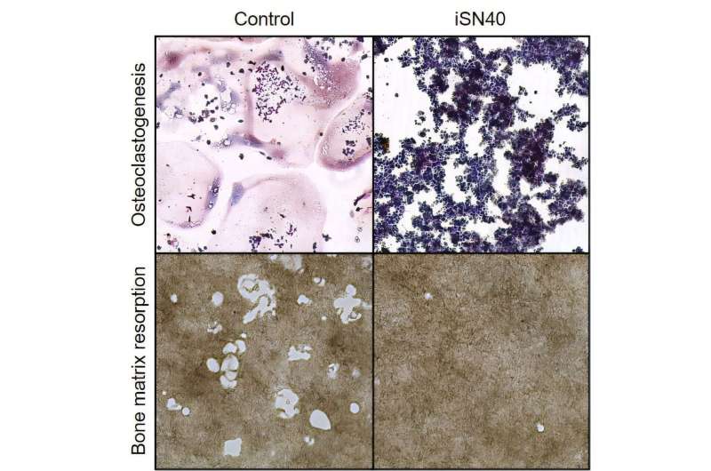 Nucleic acid drug iSN40 shows promise for osteoporosis treatment