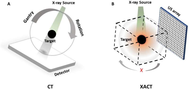 Single X-ray projection achieves 3D imaging, reducing radiation exposure