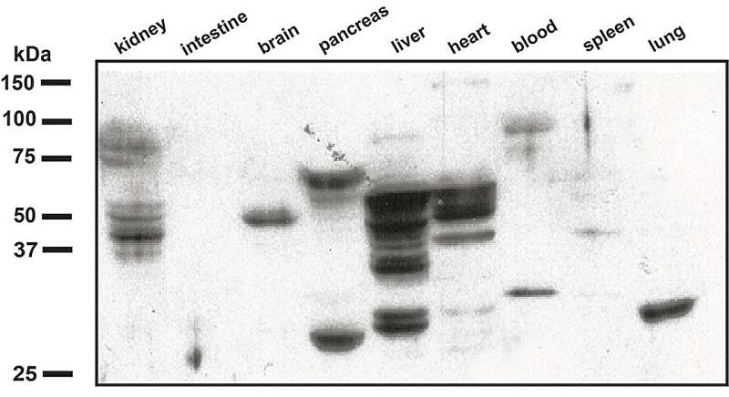 A new way to detect inflammation using antibodies developed