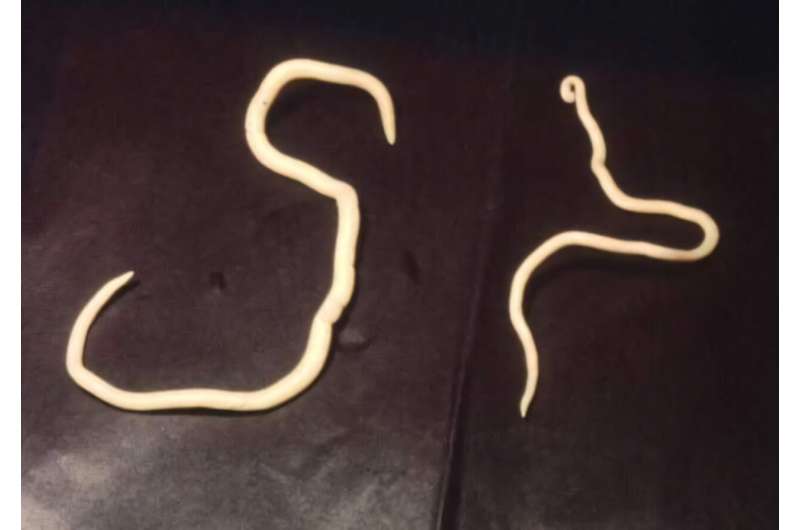 Intestinal worms could hold key to treating inflammatory bowel disease