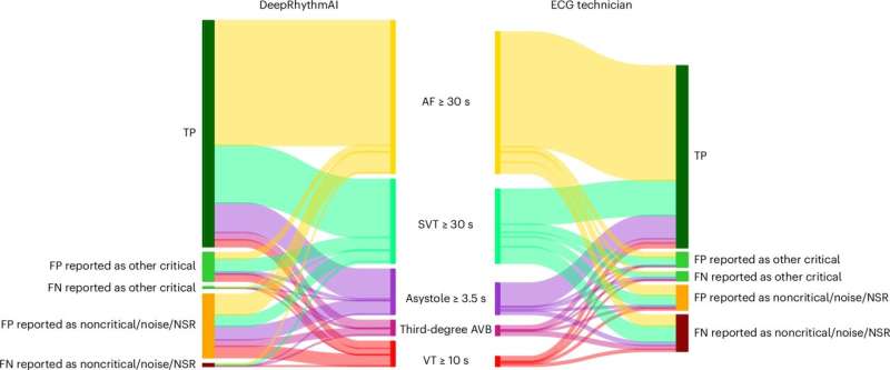 AI proves better than humans at analyzing long-term ECG recordings in large international study