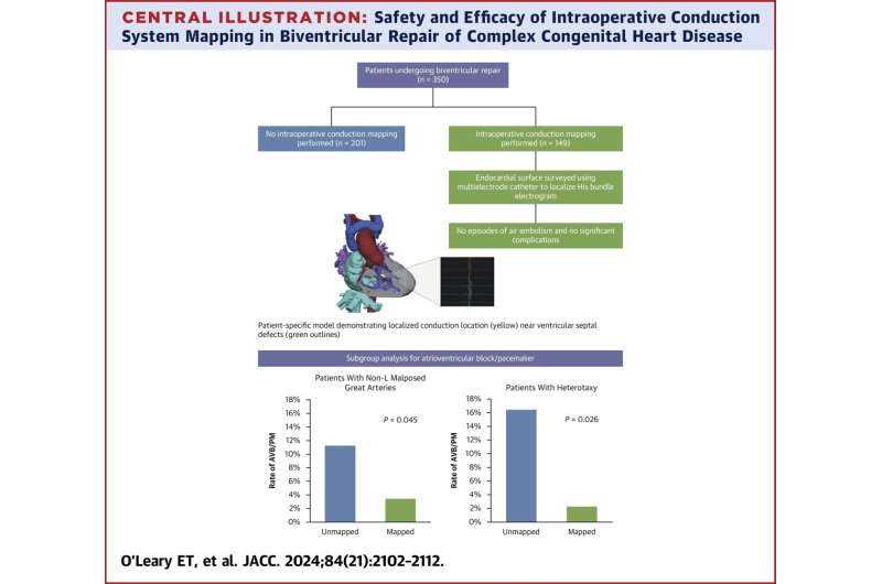 Conduction tissue mapping is shown to significantly reduce heart block