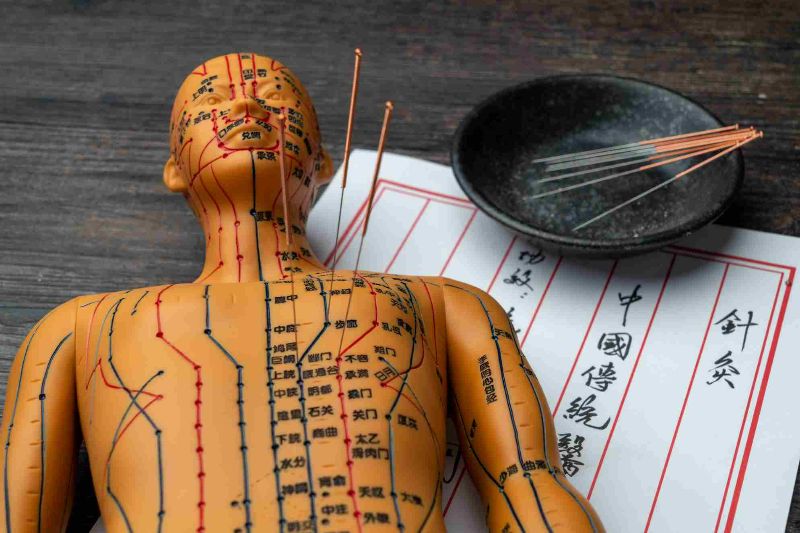 The History of Acupuncture in Traditional Chinese Medicine--A Millennia-Long Path of Empirical Validation Behind a Single Needle