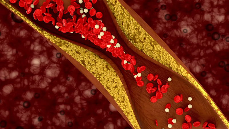 What Everyone Gets Wrong About Cholesterol